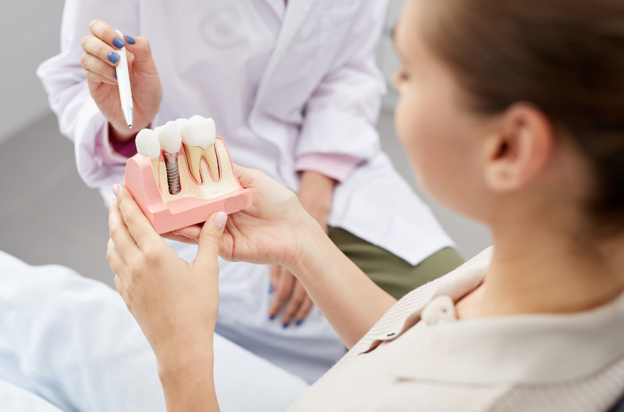 What Are Dental Implants?- Do I Need Them?