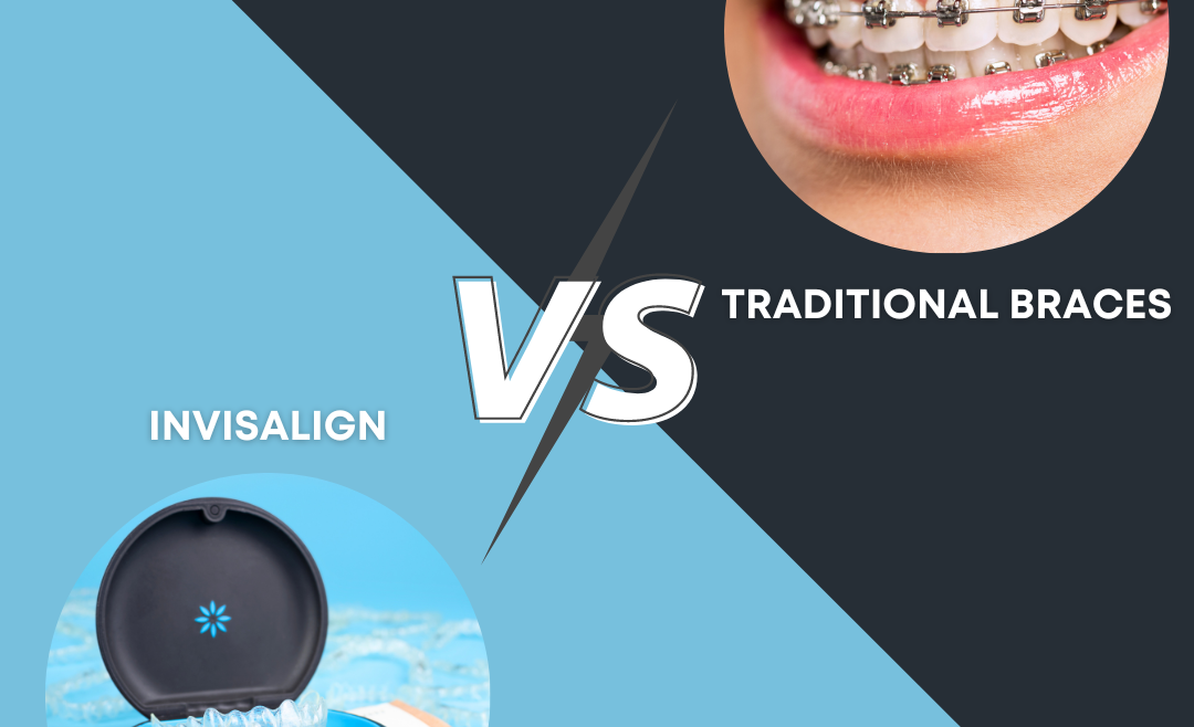 Invisalign vs. Traditional Braces