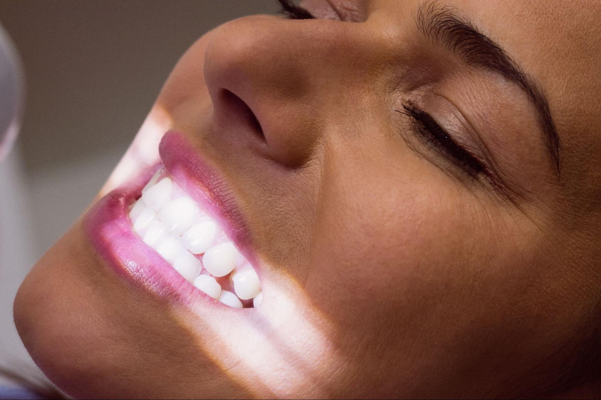 woman with white spots on teeth at the dentist
