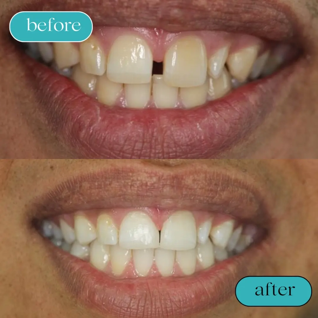 Black White Minimalist Hair Beauty Before After Instagram Post (1)