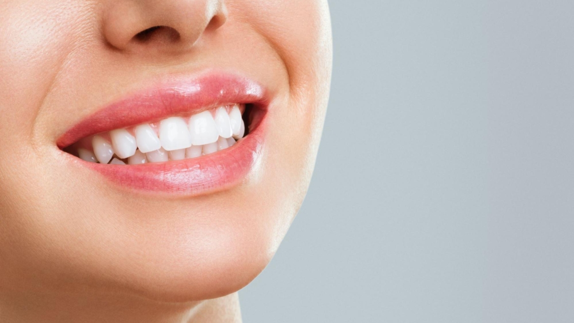 Teeth Whitening Birmingham Cost (2025)