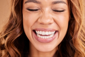 composite bonding teeth Birmingham